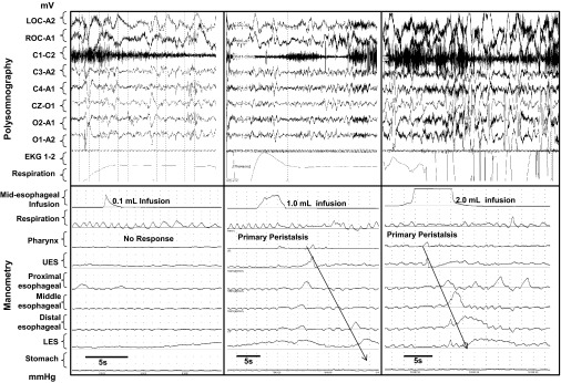 Fig. 1.