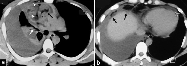 Figure 1 (a and b)