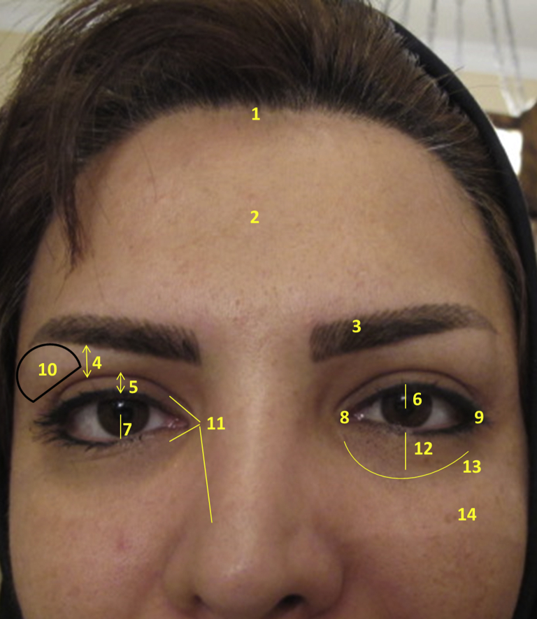 Fig. 1