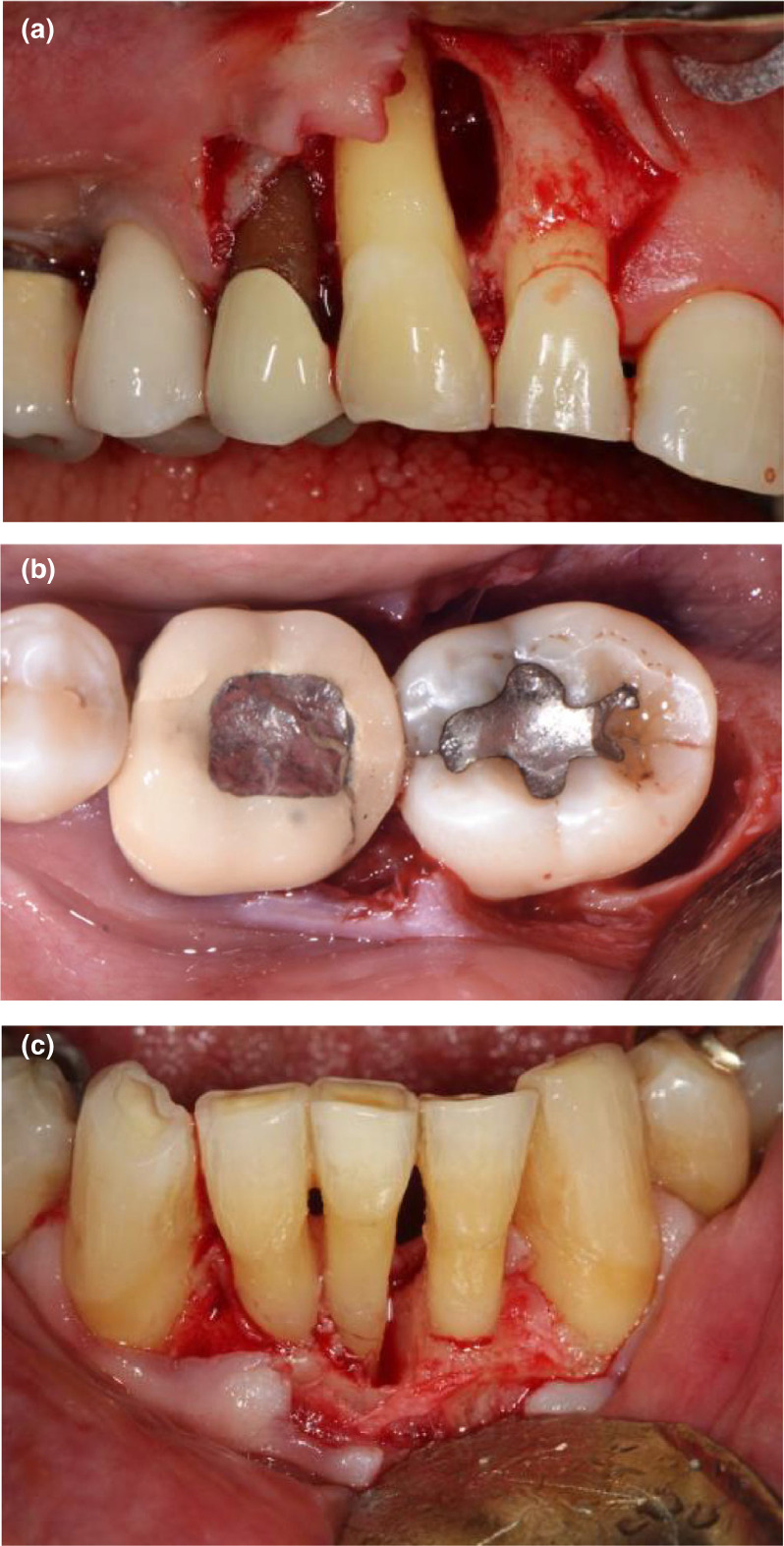 Figure 9