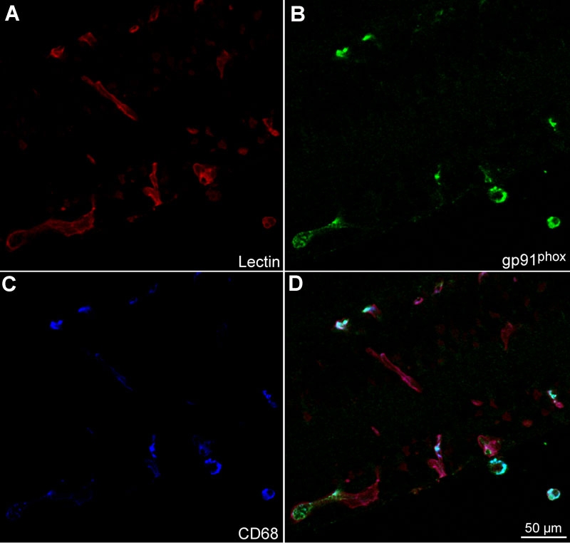 Figure 11