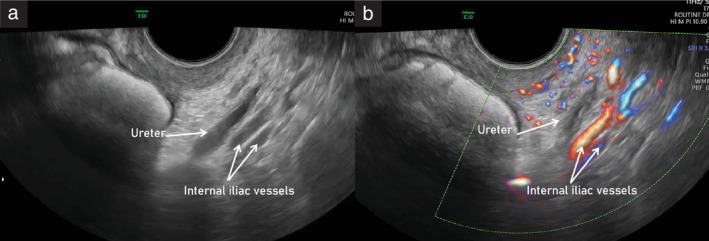 Figure 10