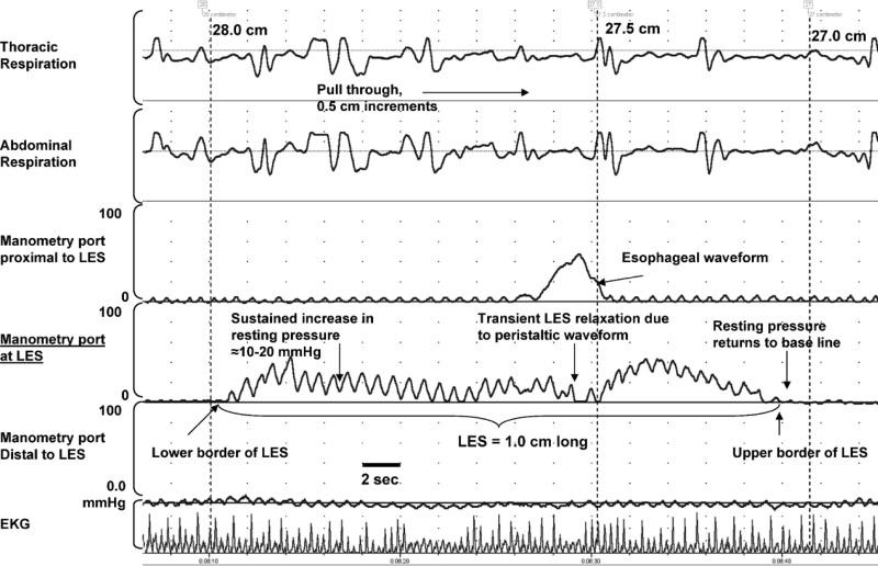 FIG. 1