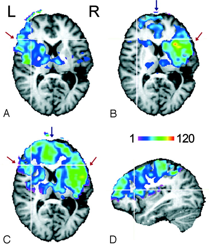 Fig 1.