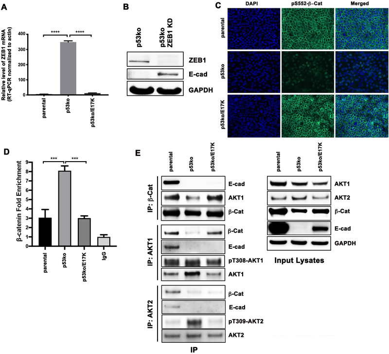 AKT1 E17K inhibits cancer cell migration by abrogating β-catenin ...