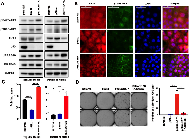 AKT1 E17K inhibits cancer cell migration by abrogating β-catenin ...