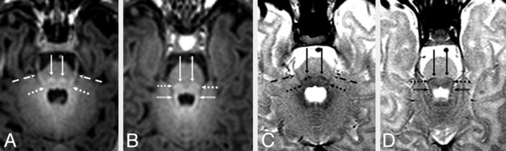 Fig 3.