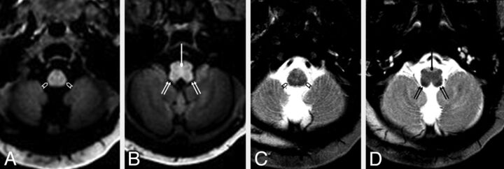 Fig 4.