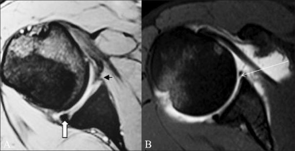 Figure 1 (A,B)