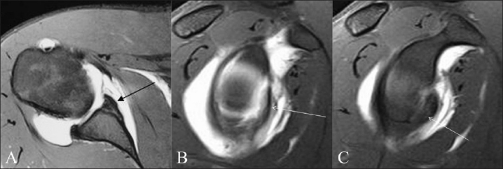 Figure 3 (A-C)