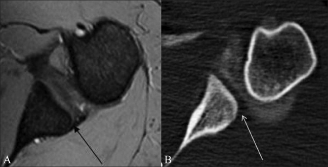 Figure 16 (A-B)