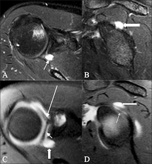 Figure 18 (A-D)