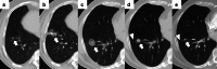 Fig. 16