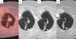 Fig. 13