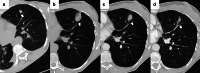 Fig. 17