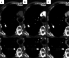 Fig. 18