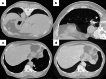 Fig. 11