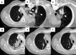 Fig. 12