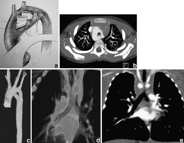 Fig. 11