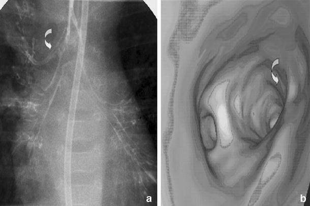 Fig. 13