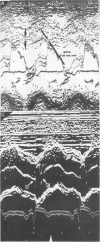 114