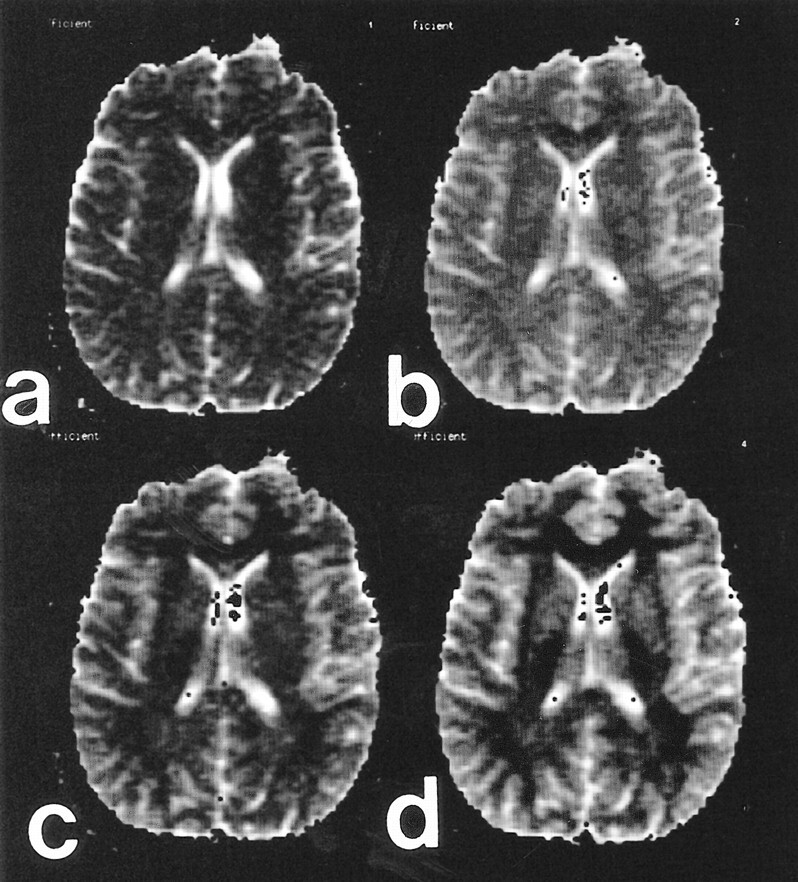 fig 3.