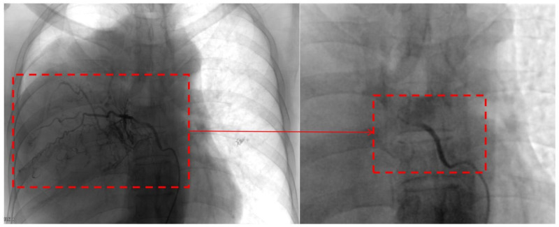 Figure 3