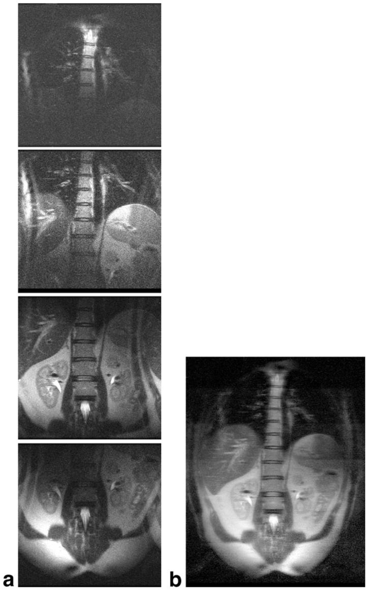 FIG. 7