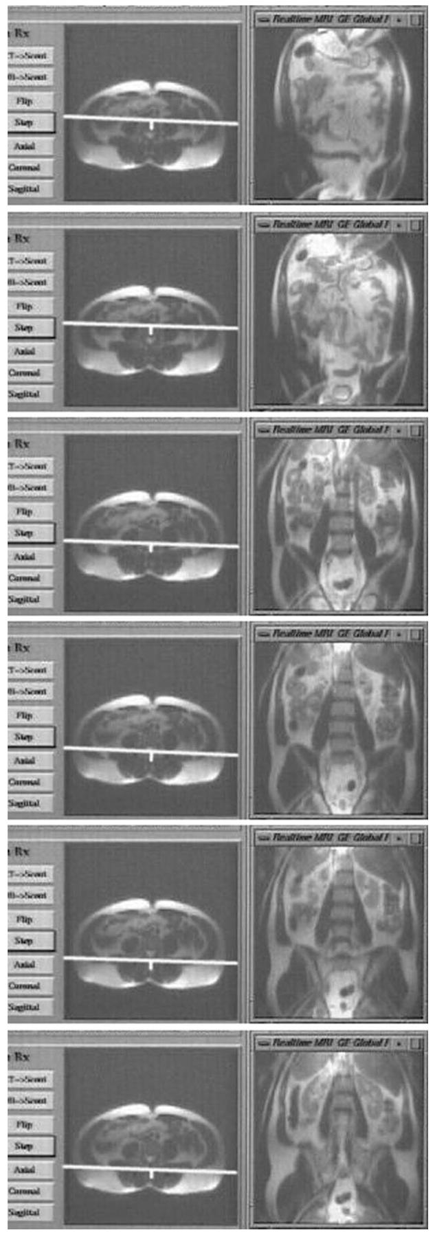 FIG. 5