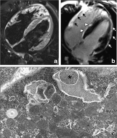 Fig. 11