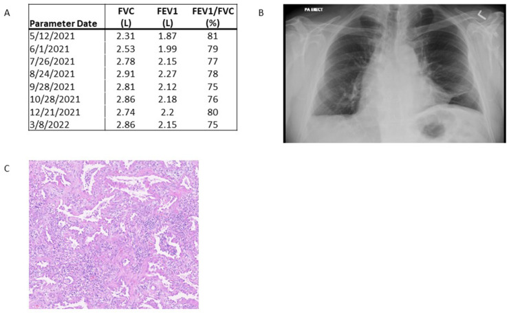 Figure 1