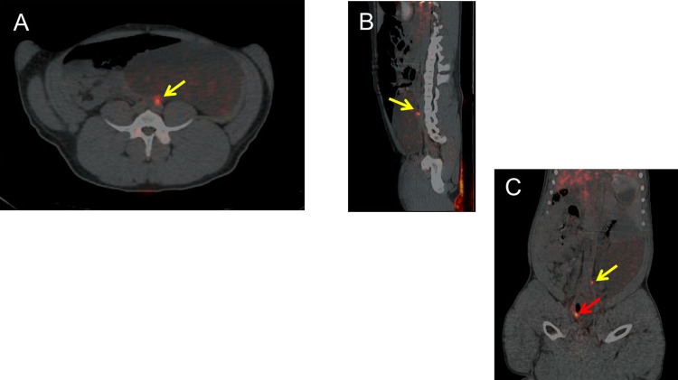 Fig 2