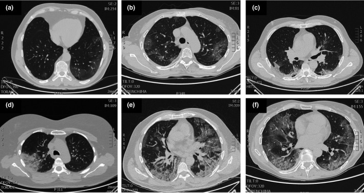 Fig. 1