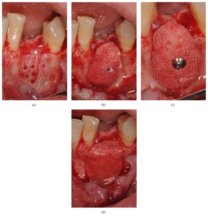 Figure 5