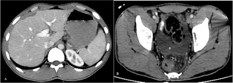 Fig. 3: