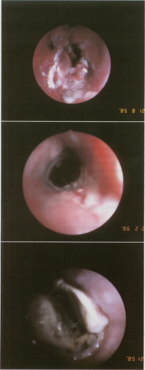 Fig. 2.,Fig. 3.,Fig. 4.