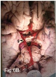 [Table/Fig-6B]: