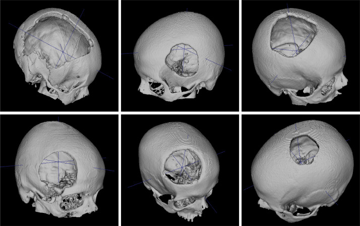 Fig. 3