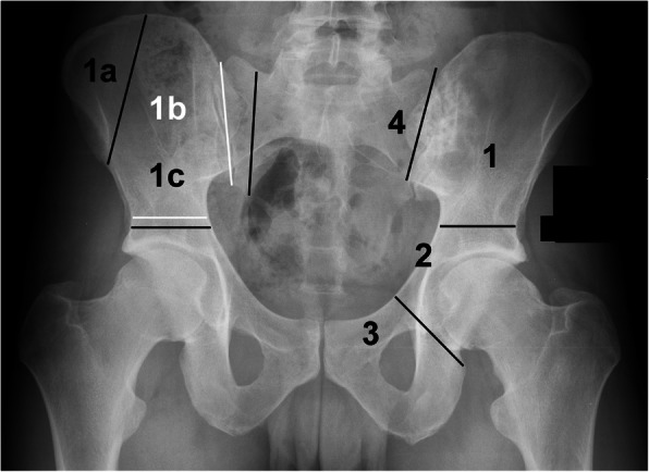 Fig. 1