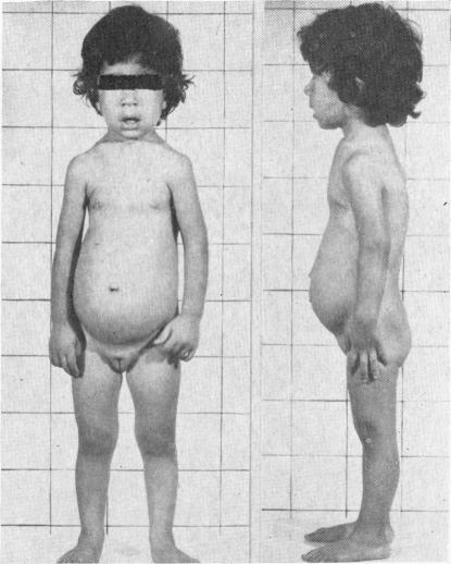 Fig. 1a, b