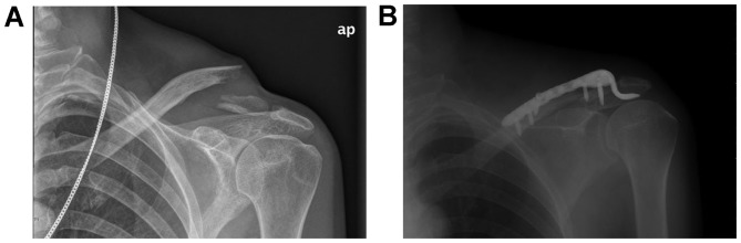 Figure 2.