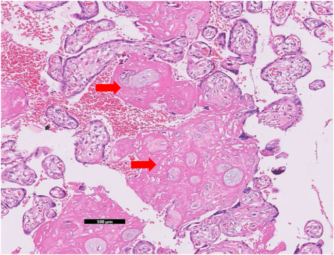 Fig. 1