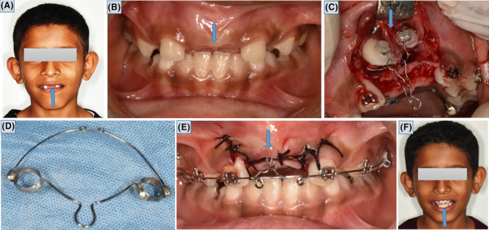 FIGURE 3