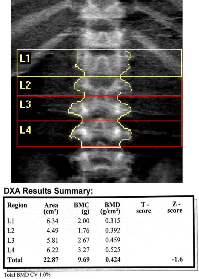 Figure 13