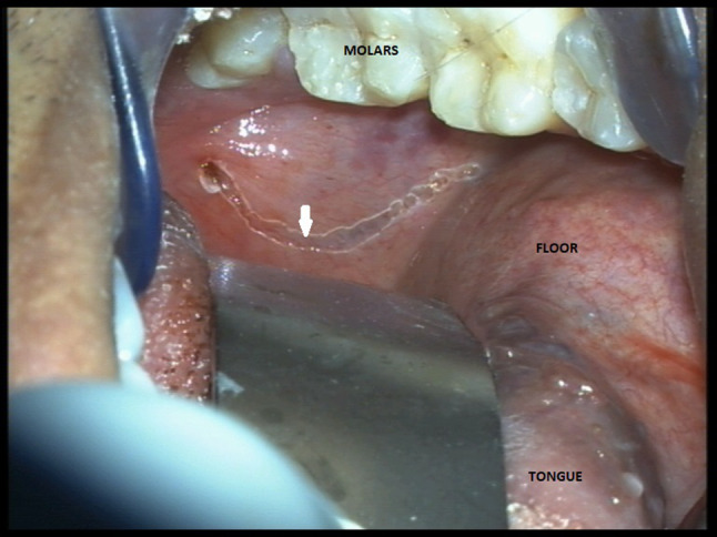 Fig. 1