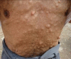 Fig. 4