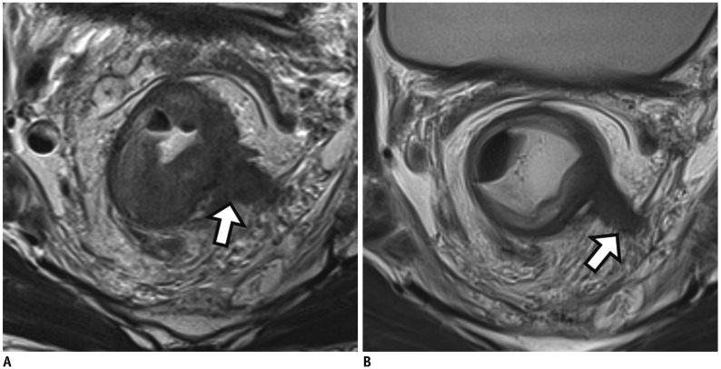 Fig. 11