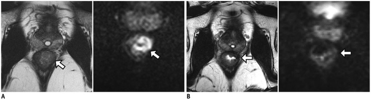 Fig. 12