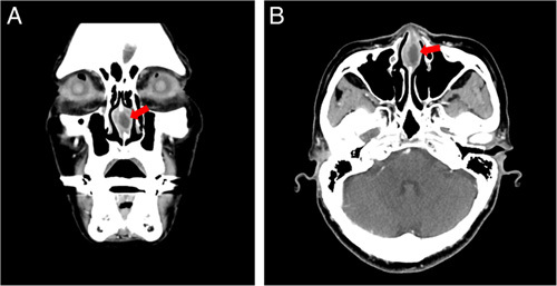 FIGURE 2