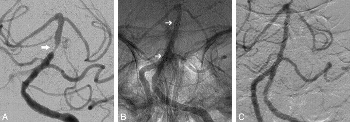 Fig 2.